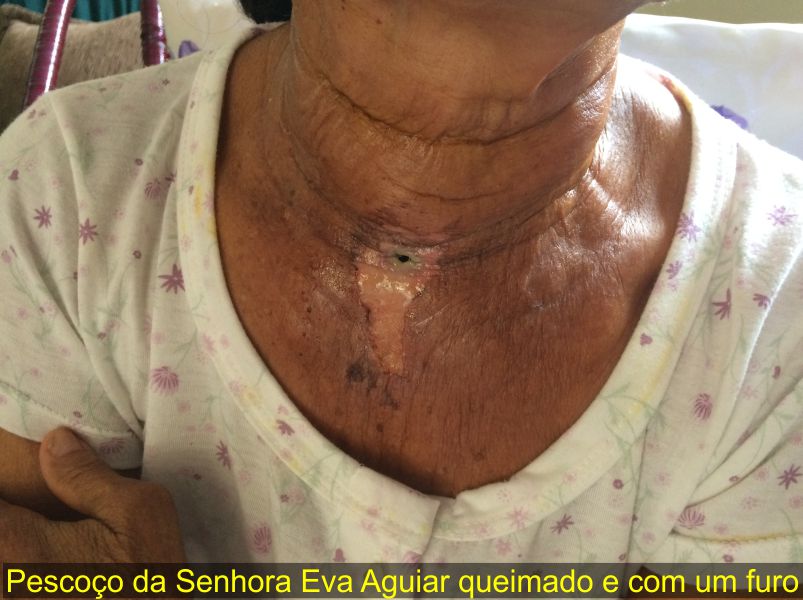 imagem do site www.tocnoticias.com.br