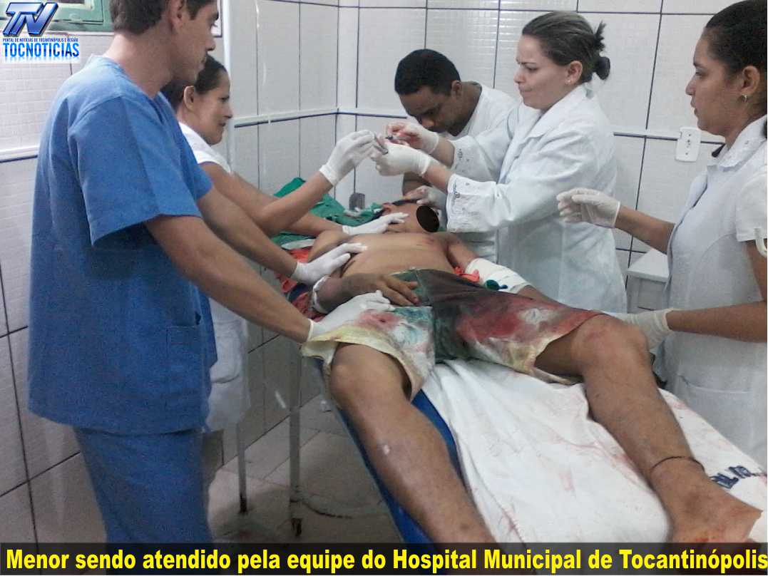 imagem do site www.tocnoticias.com.br